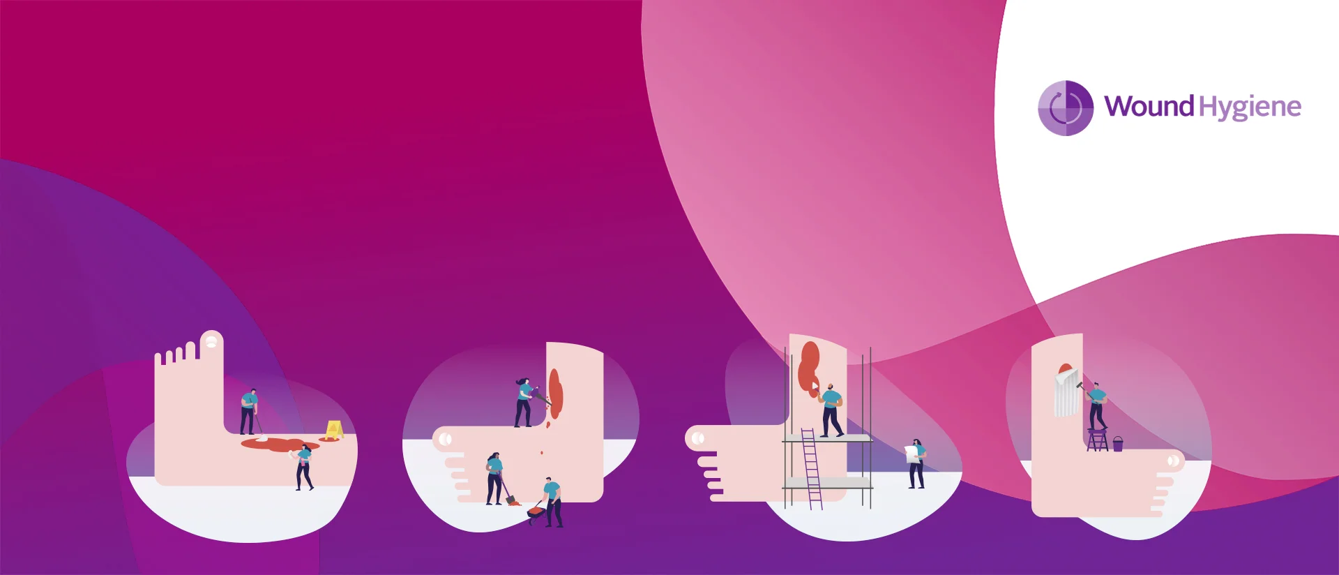 Een reeks illustraties van mensen die aan een reusachtige voet werken die het stapsgewijze genezingsproces vertegenwoordigt. De tekst "Wondhygiëne" is over de afbeelding heen gelegd.