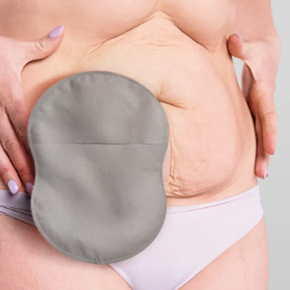 A closeup shot of a woman using an 8-shaped ostomy pouch with Leak Defense™.