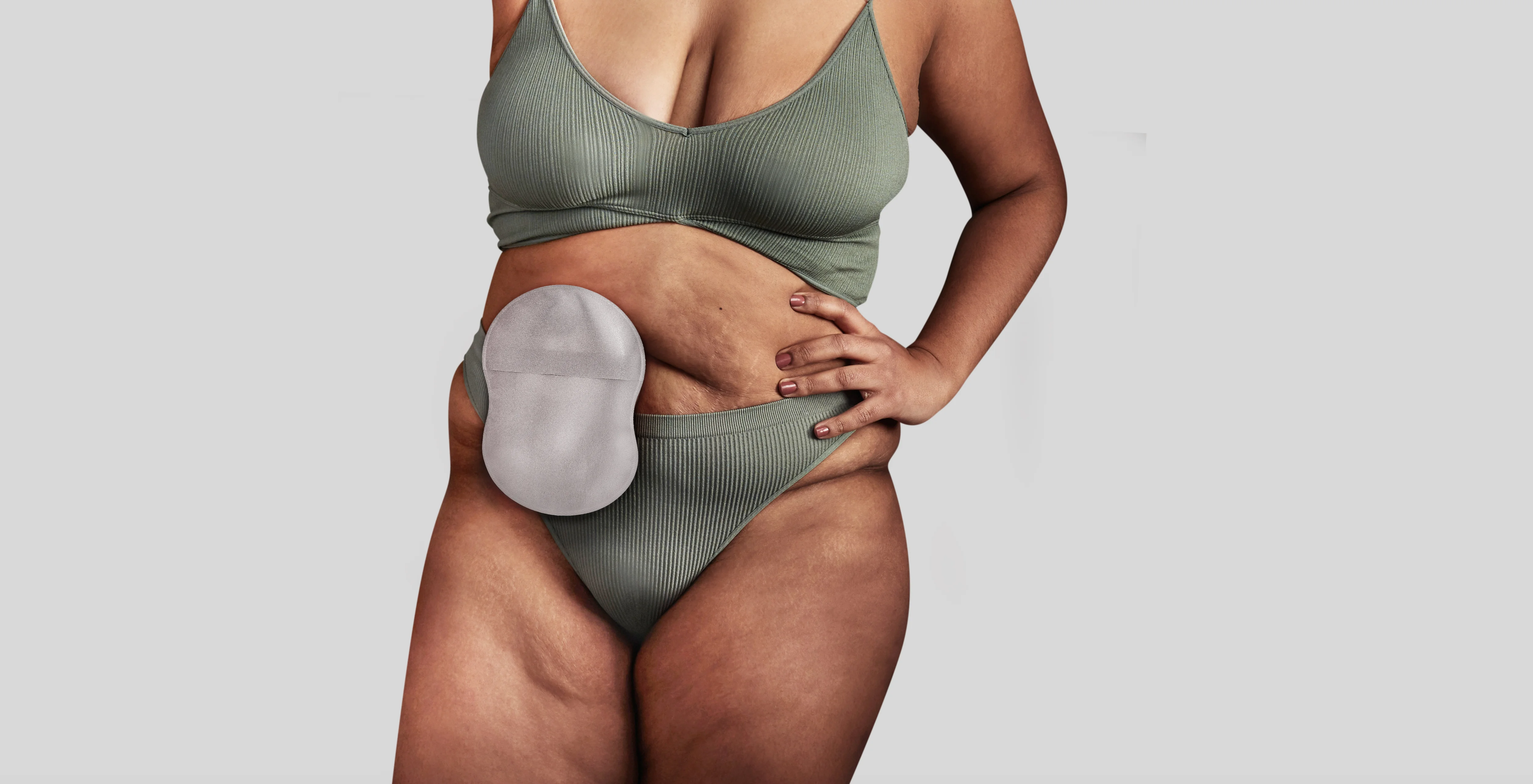 Kvinne iført en Esteem Body-pose™ med stomi