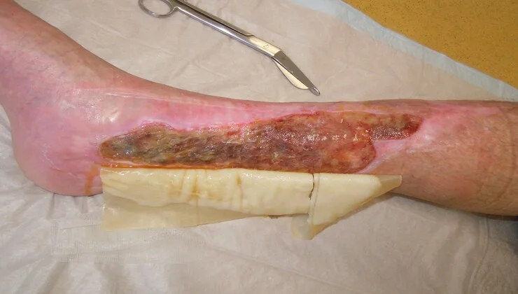 eine Person, die ein Stück Fleisch hält