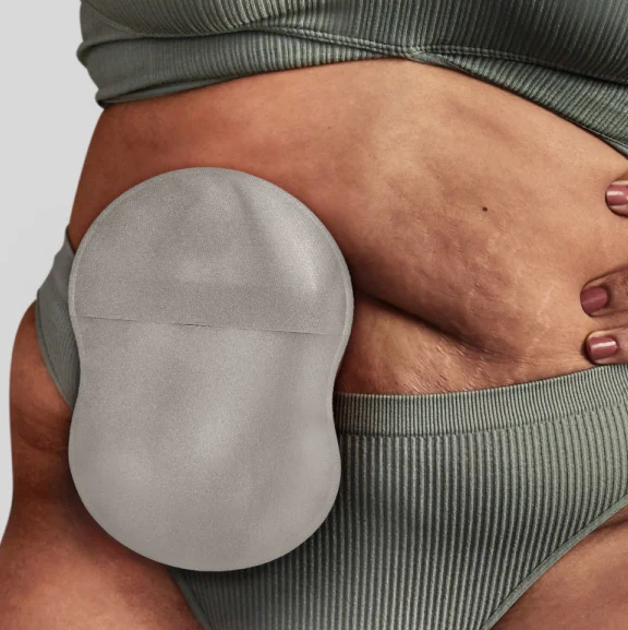 A closeup shot of a woman wearing an 8-shaped ostomy pouch with Leak Defense™.