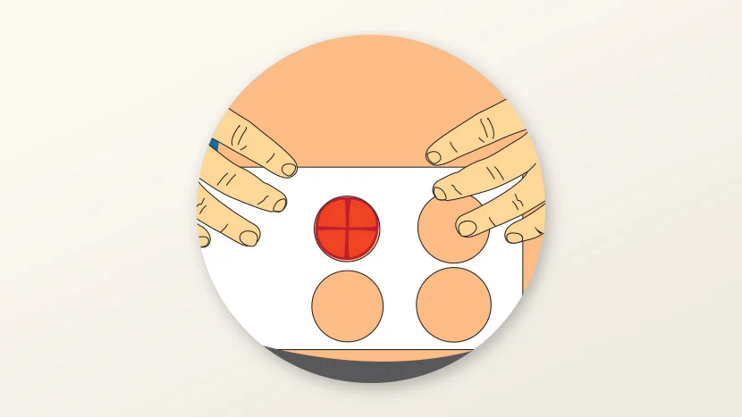 Illustration of how to measure a stoma